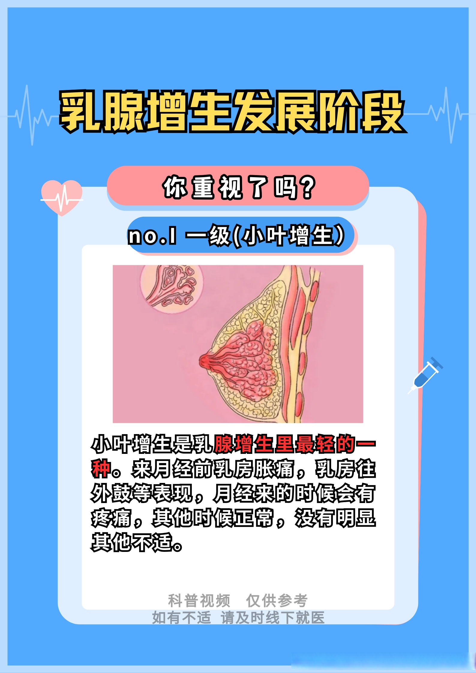 乳腺增生钙化是什么意思