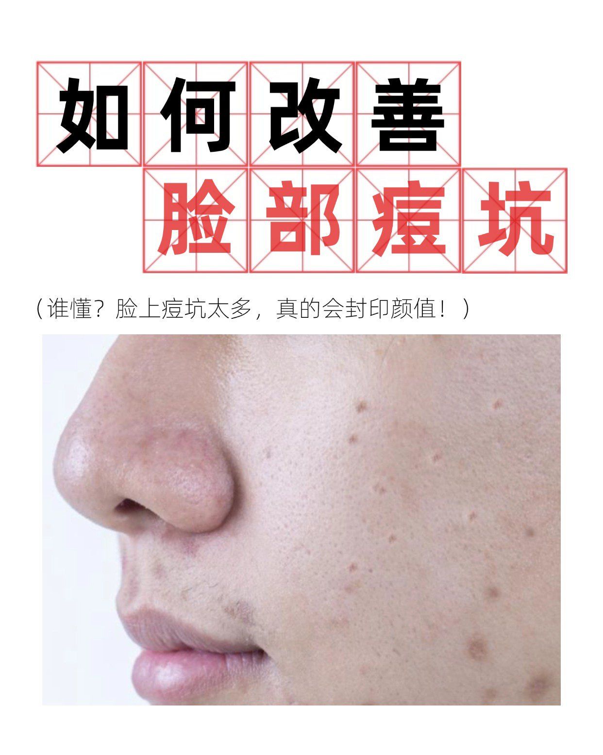 脸上有很多坑坑洼洼的,怎么办