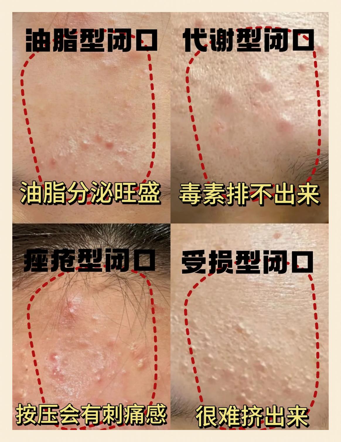 2026年1月11日 第23页