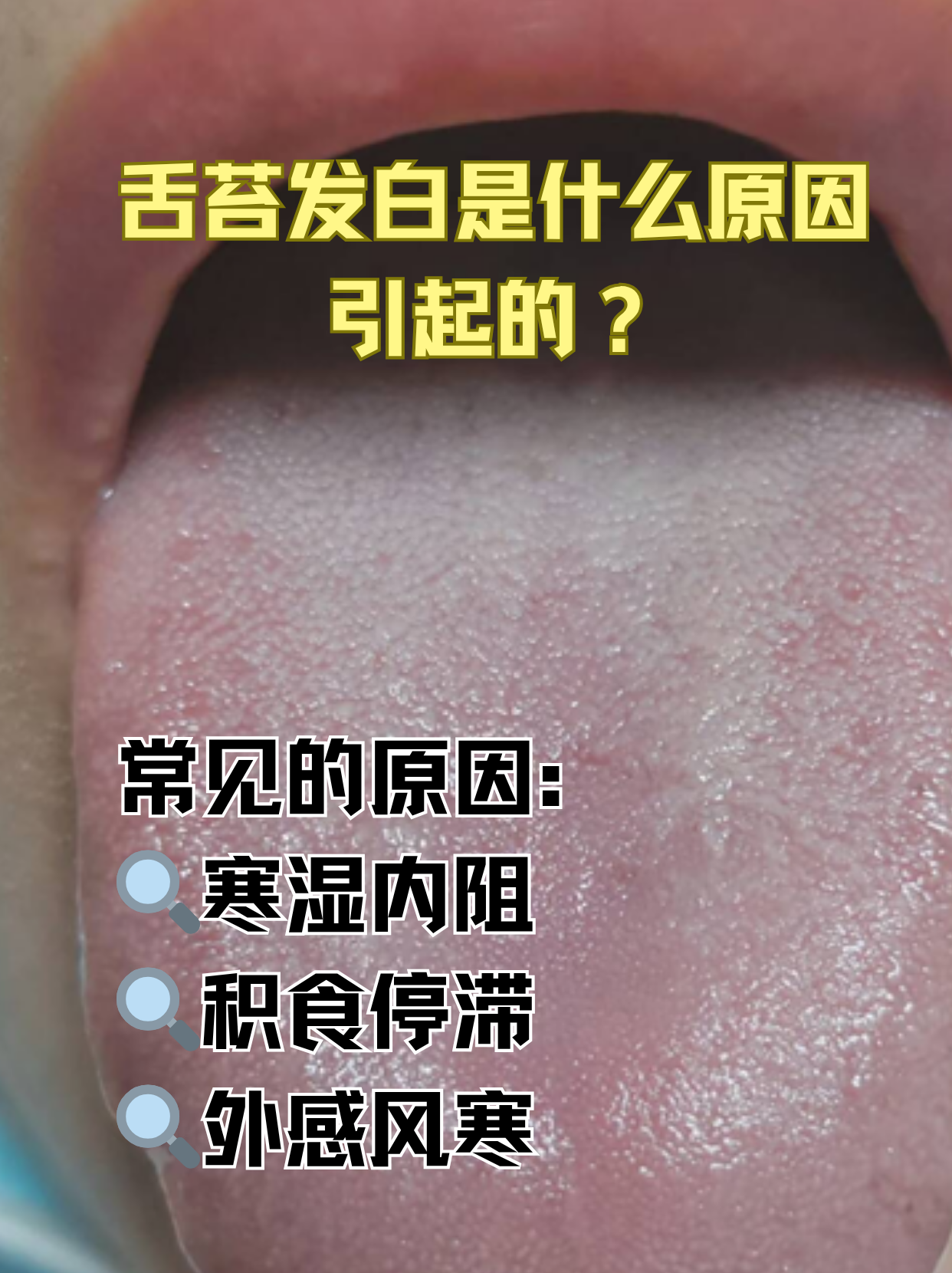 小孩子舌苔发白怎么回事?