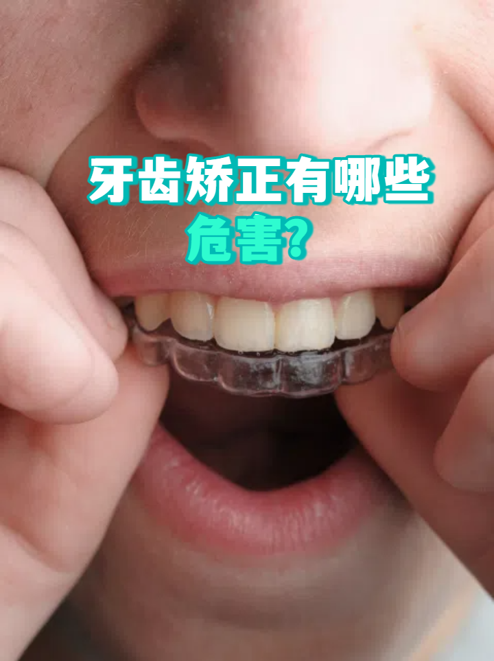 牙齿矫正的危害有哪些