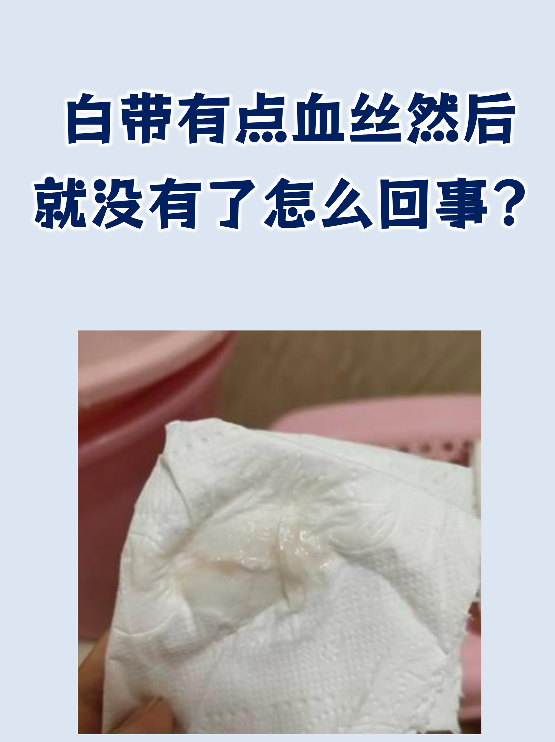 排卵期没有白带拉丝正常吗