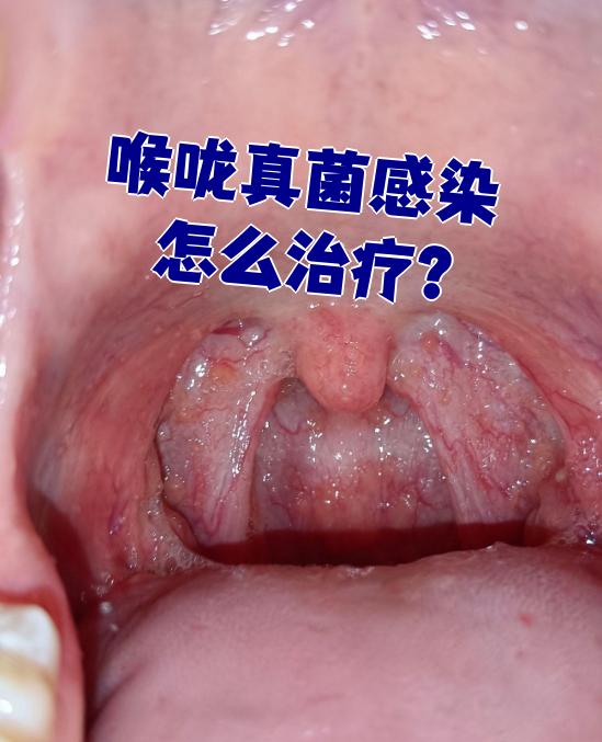 2026年1月11日 第10页