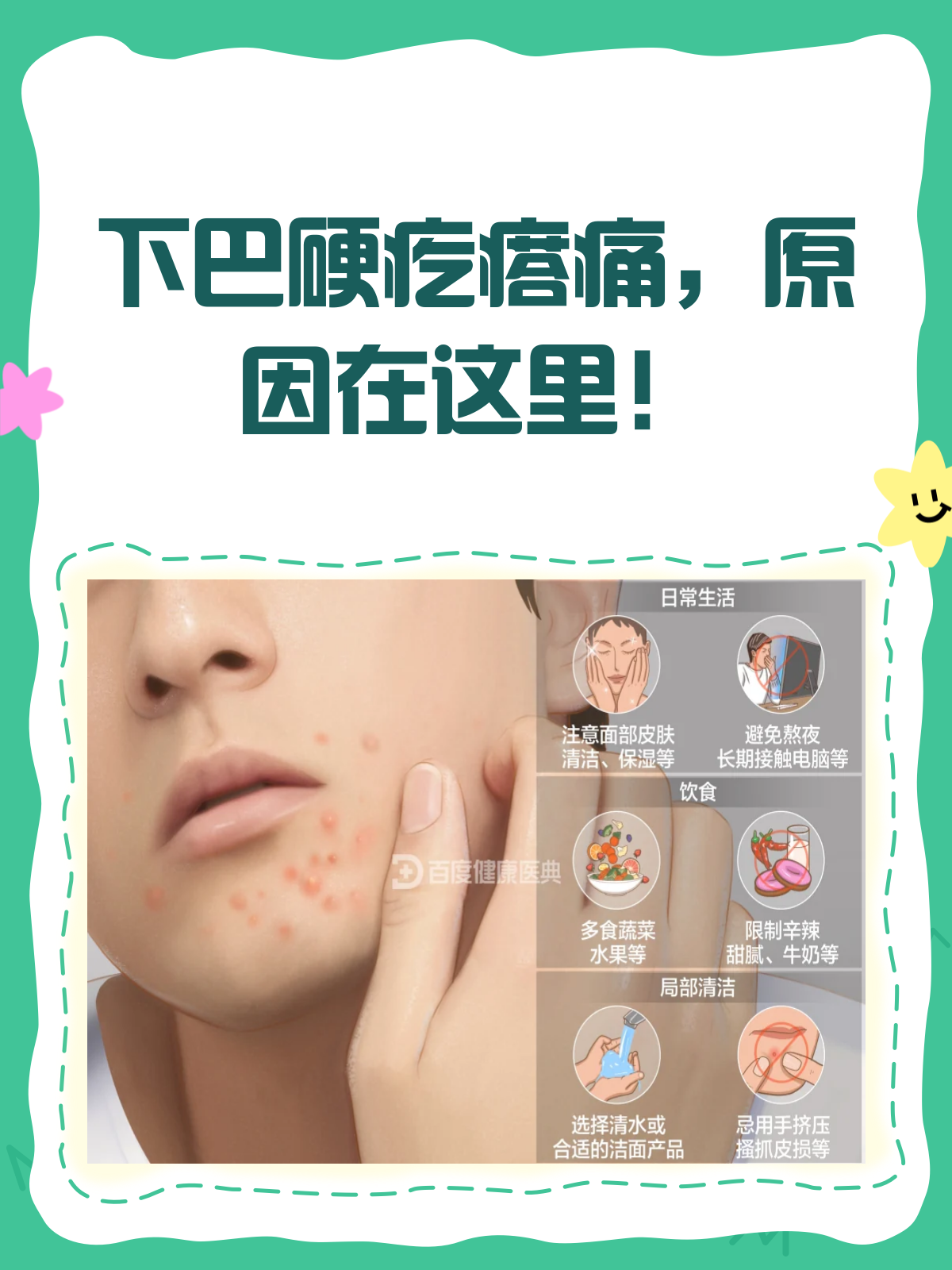 下巴长了个硬包按着痛