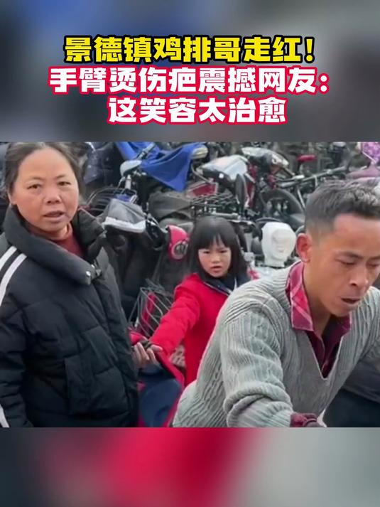 胳膊上有一个烟头烫的疤可不可以当兵180厘米体重6