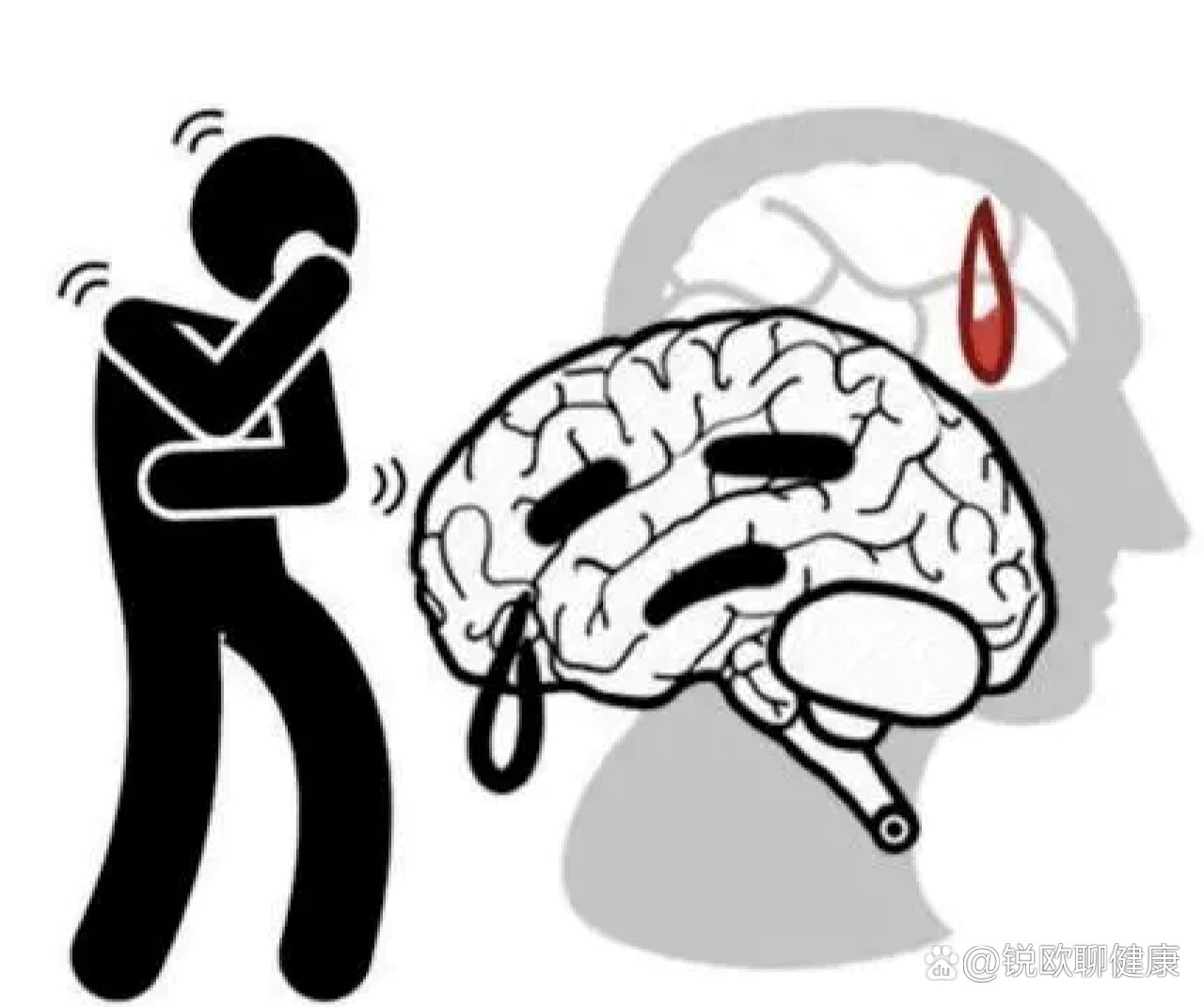 为什么脑出血怕第二次?