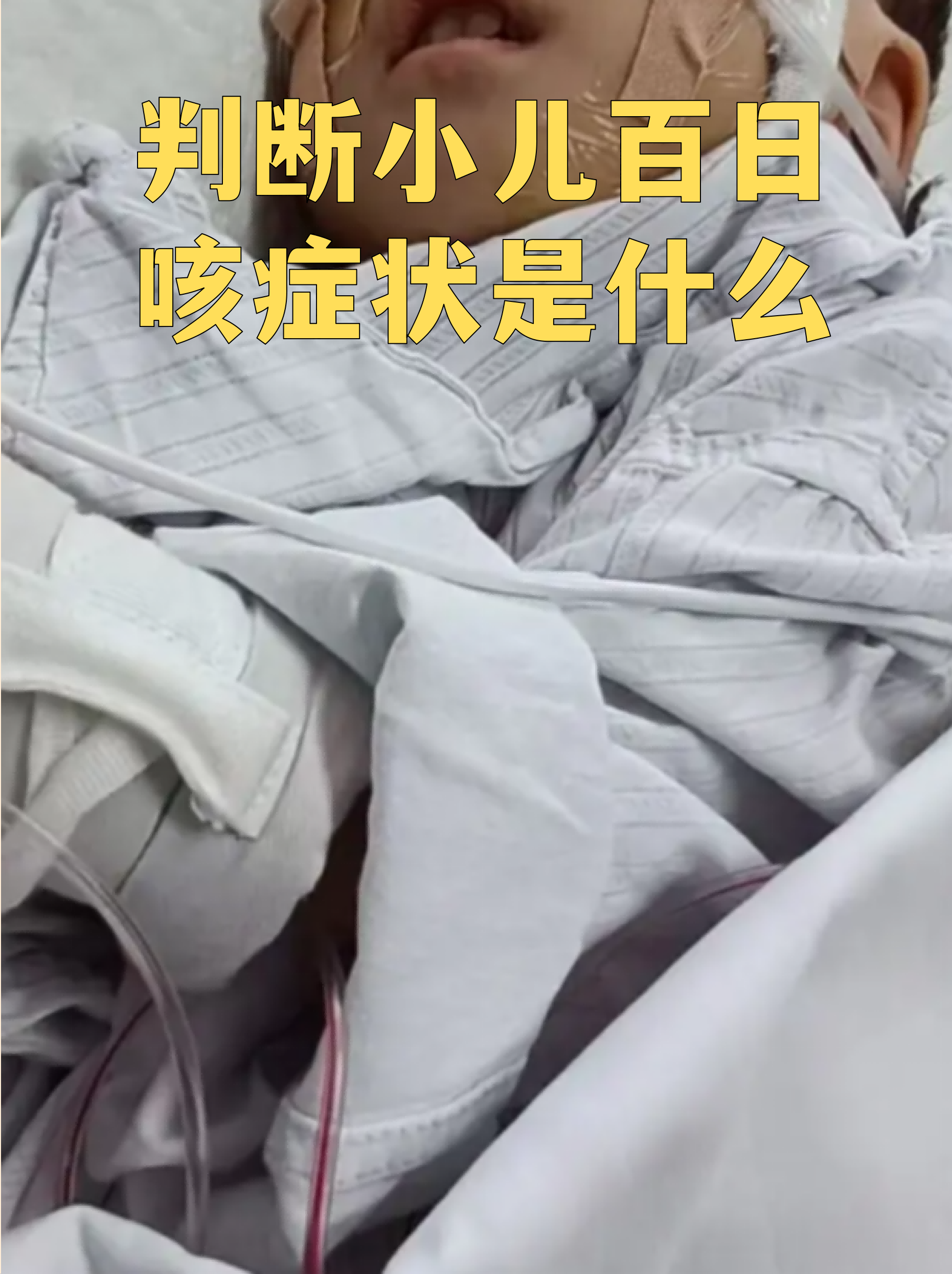 百日咳的症状有哪些