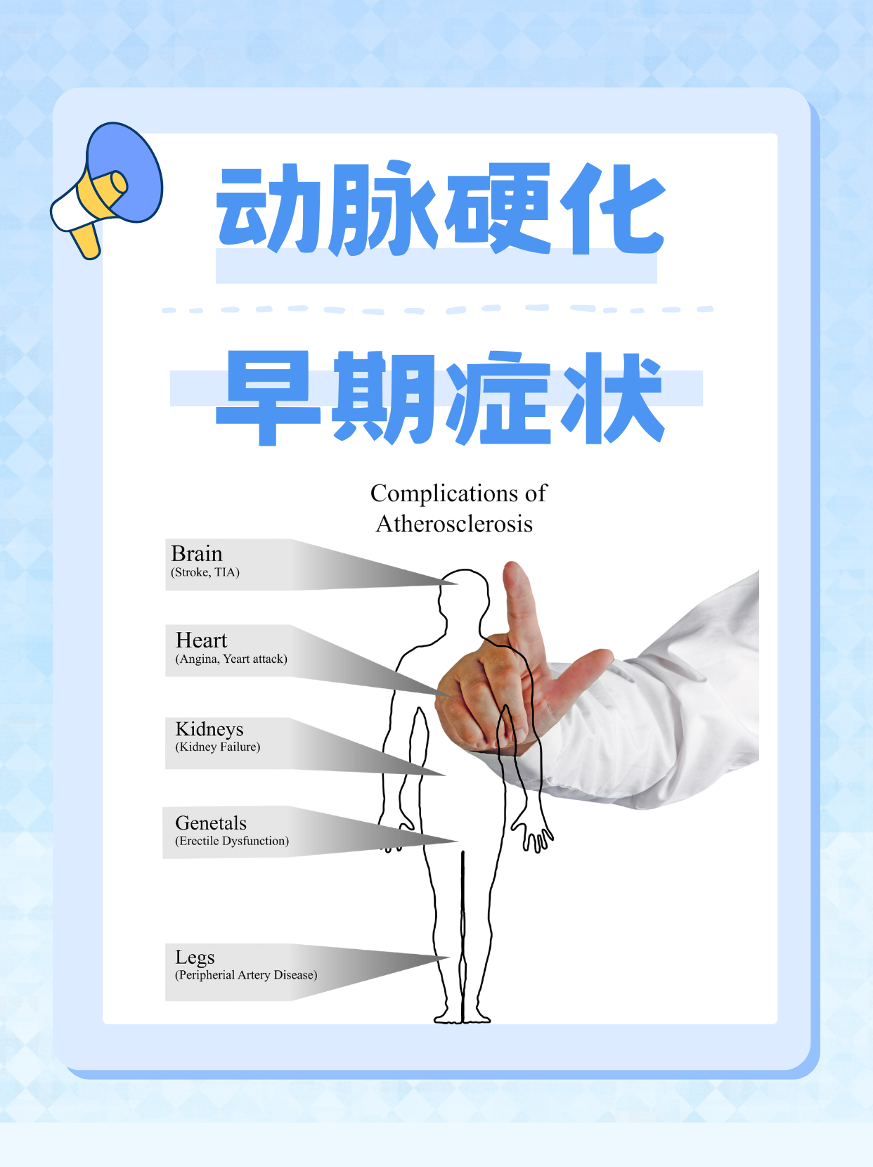 心脑血管病前期症状有哪些?