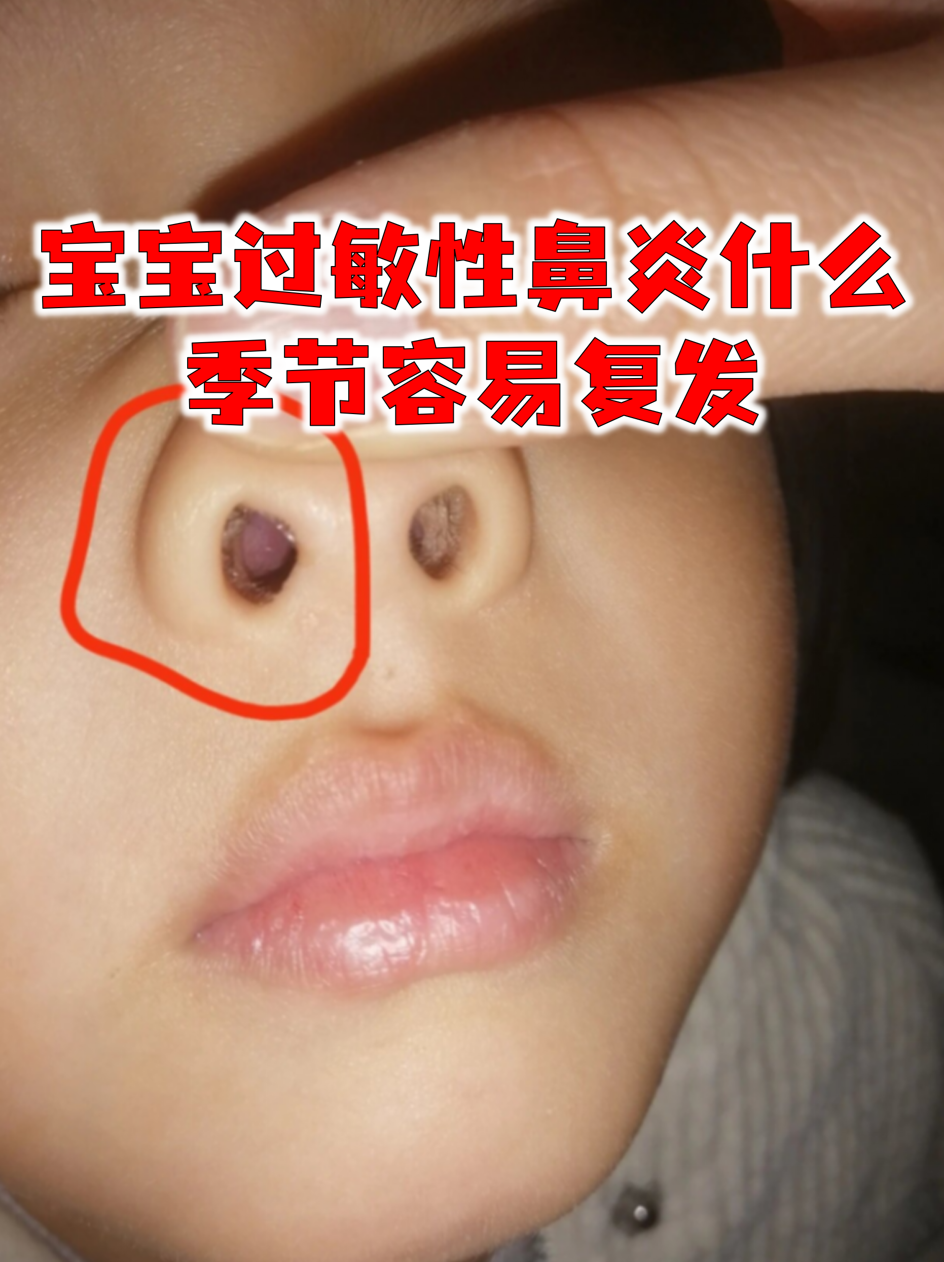 婴儿打喷嚏是什么原因