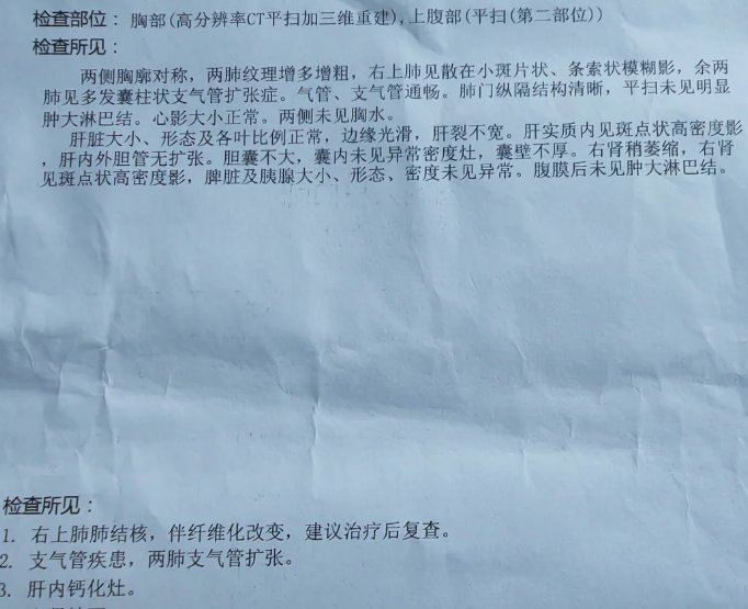 肺结节就是肺癌吗