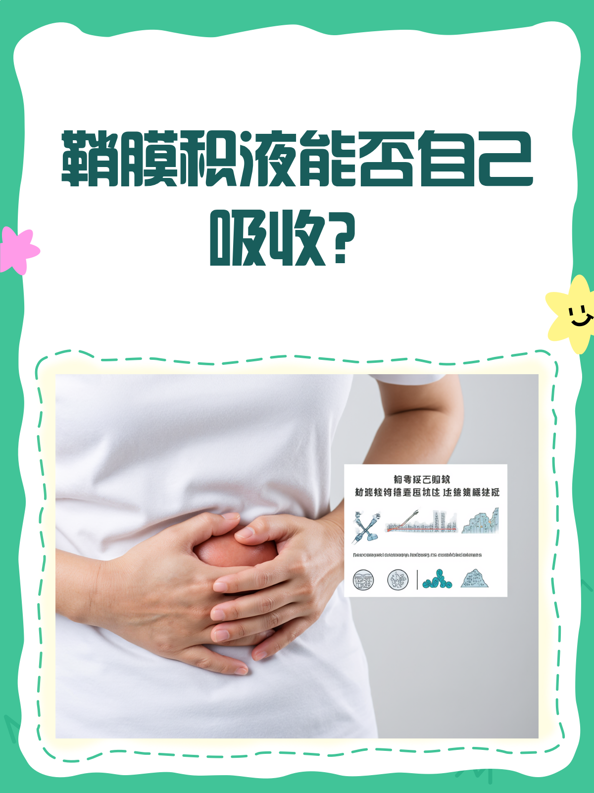 婴儿鞘膜积液能自愈吗