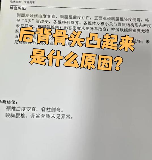 后背脊椎骨头突起来了