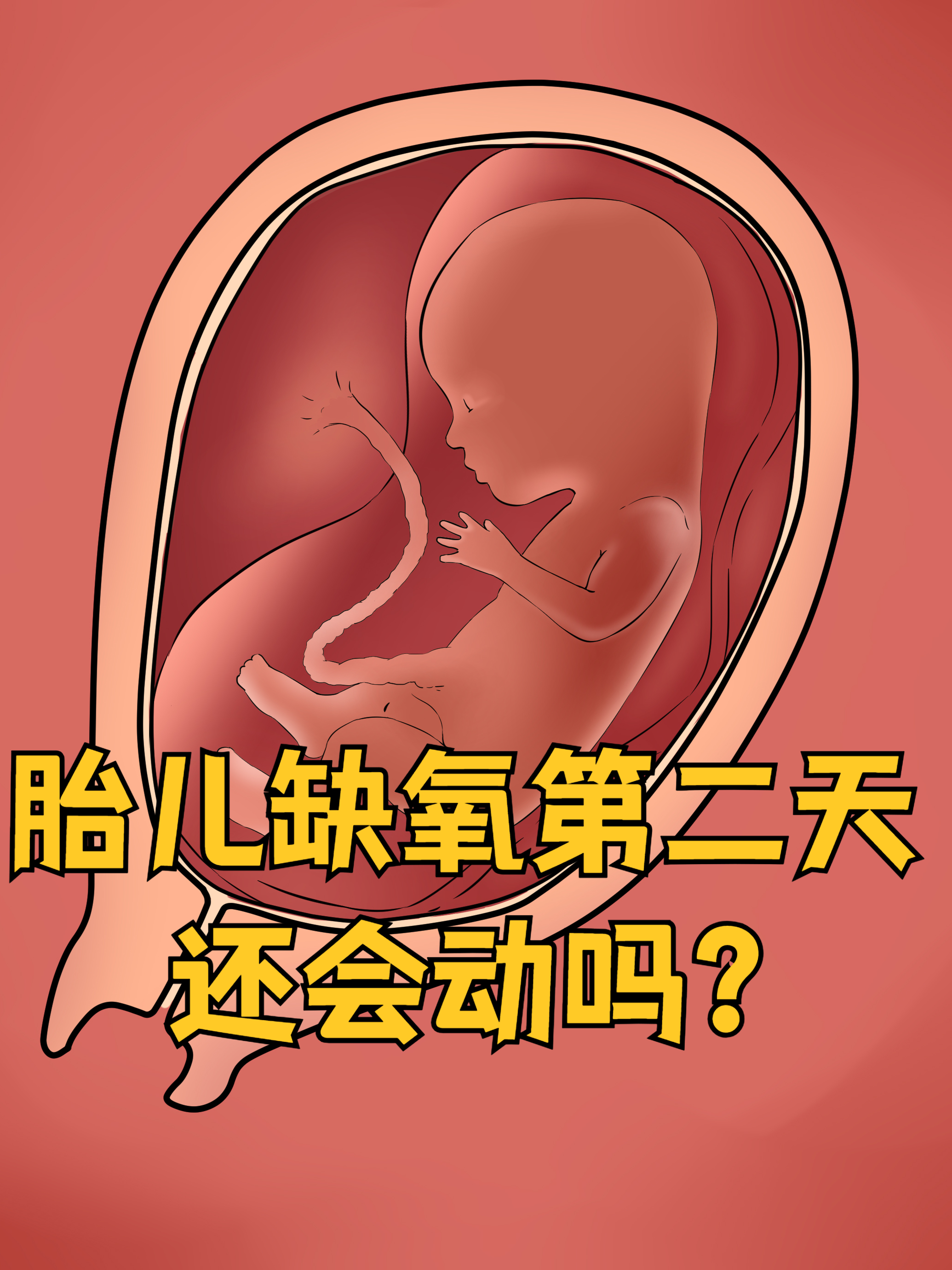 胎儿宫内缺氧的原因