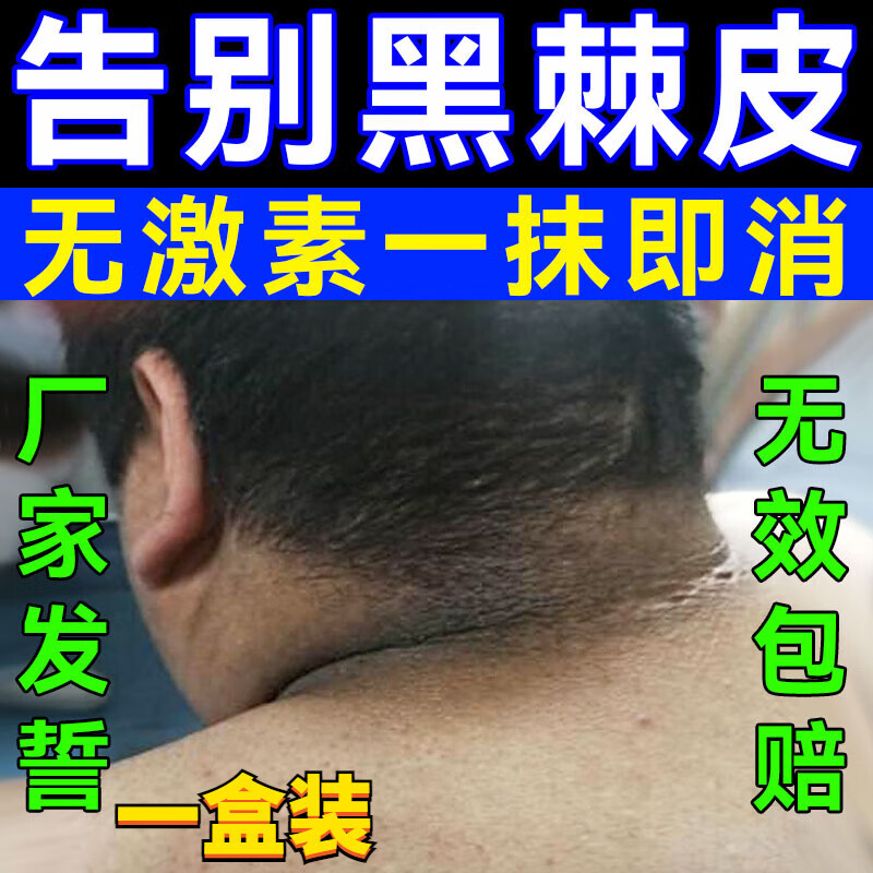 黑棘皮病能彻底治好吗