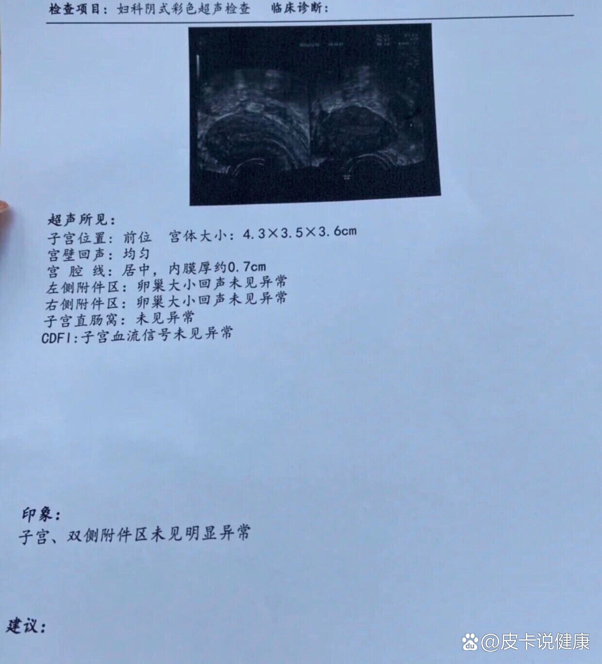 超导可视无痛人流费用多少啊