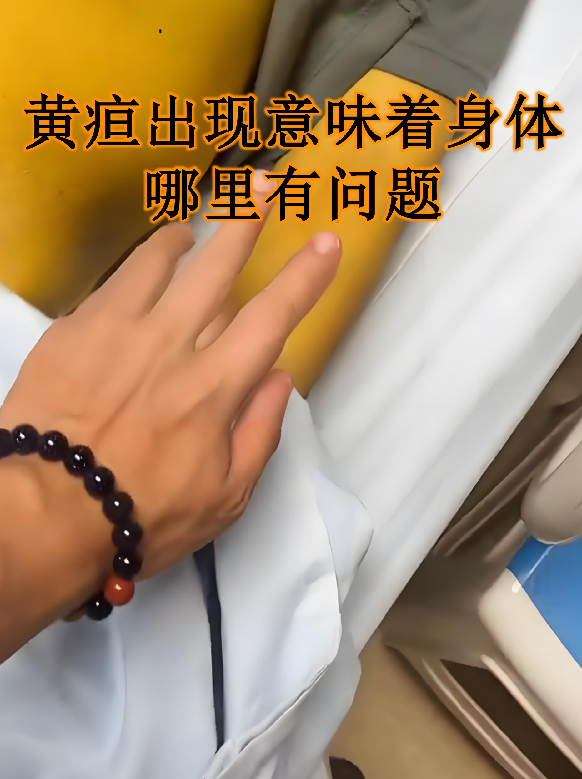 黄疸高了有什么危害
