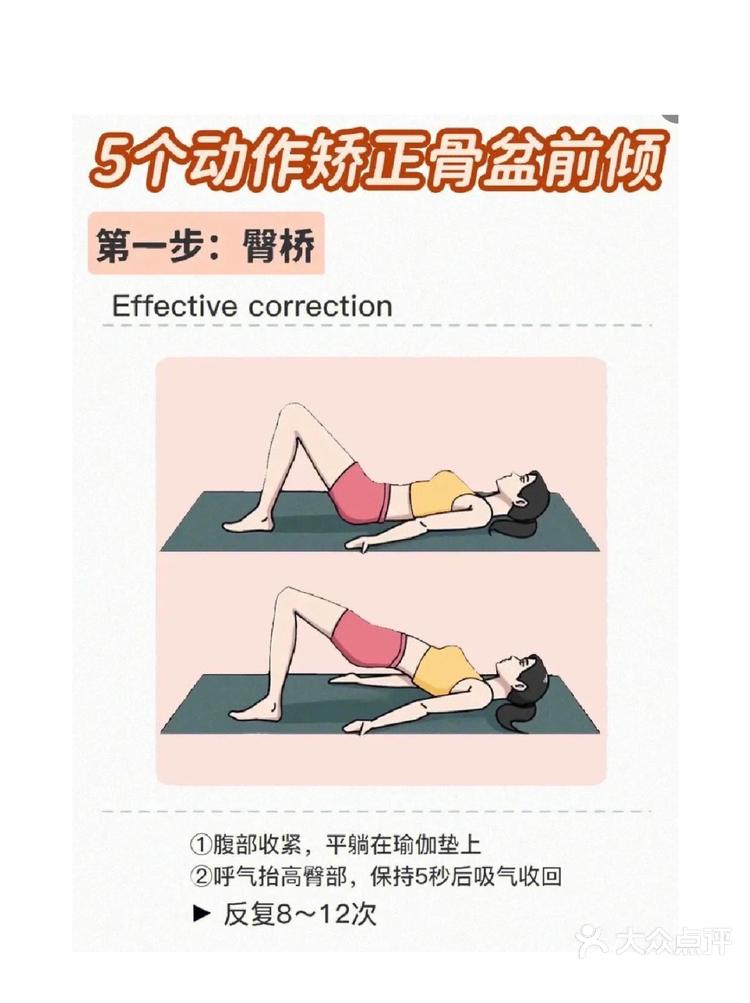 骨盆前倾怎么才能纠正?