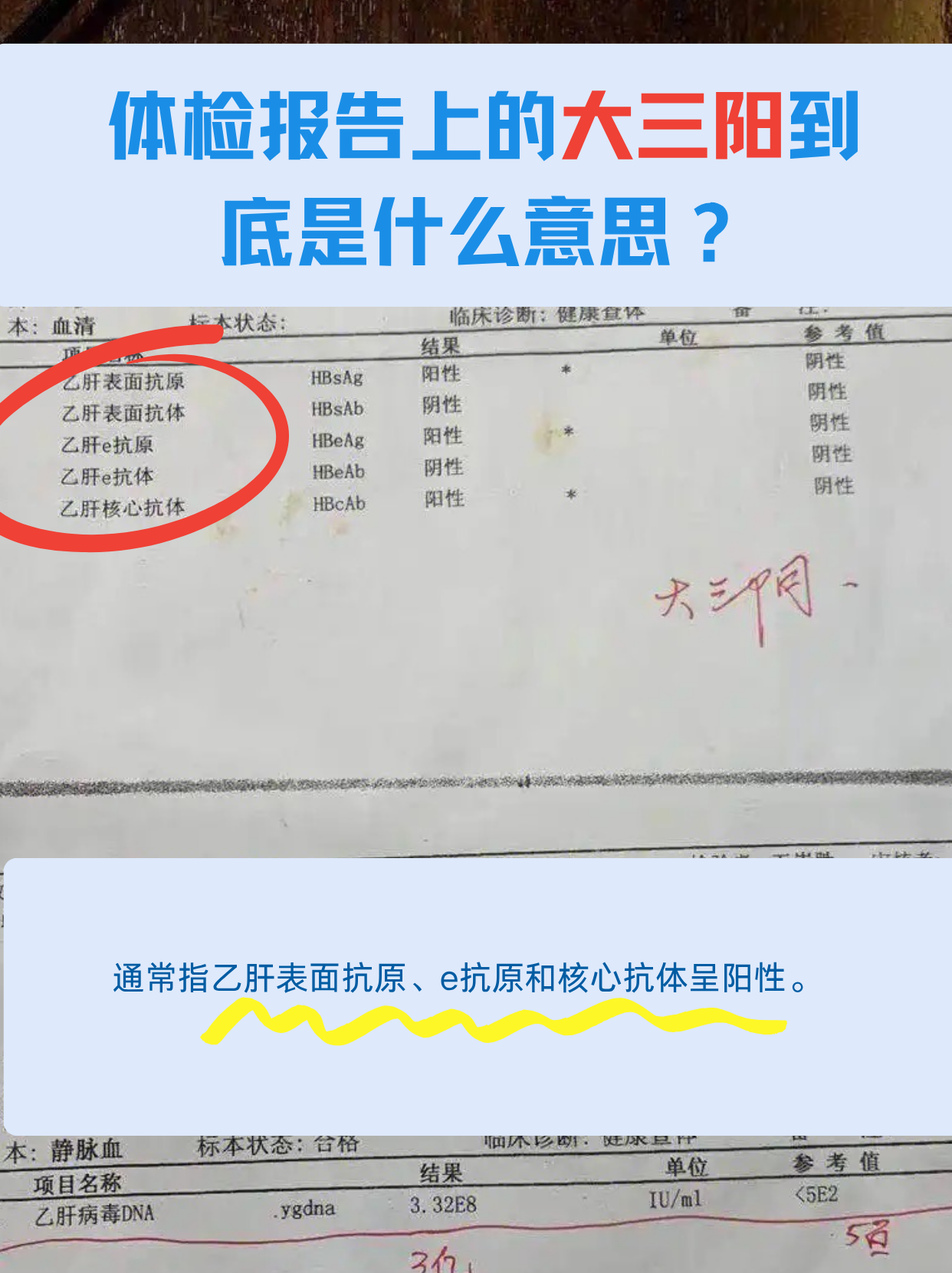 乙型肝炎核心抗体阳性是什么意思