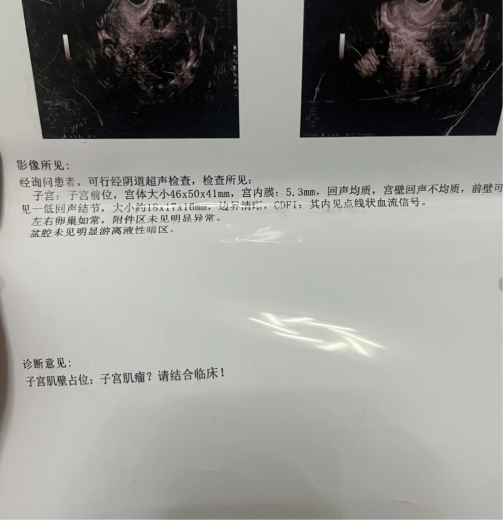 一般宫腔镜手术多少钱