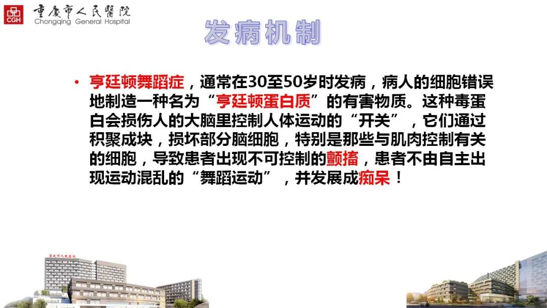 舞蹈症是一种什么病