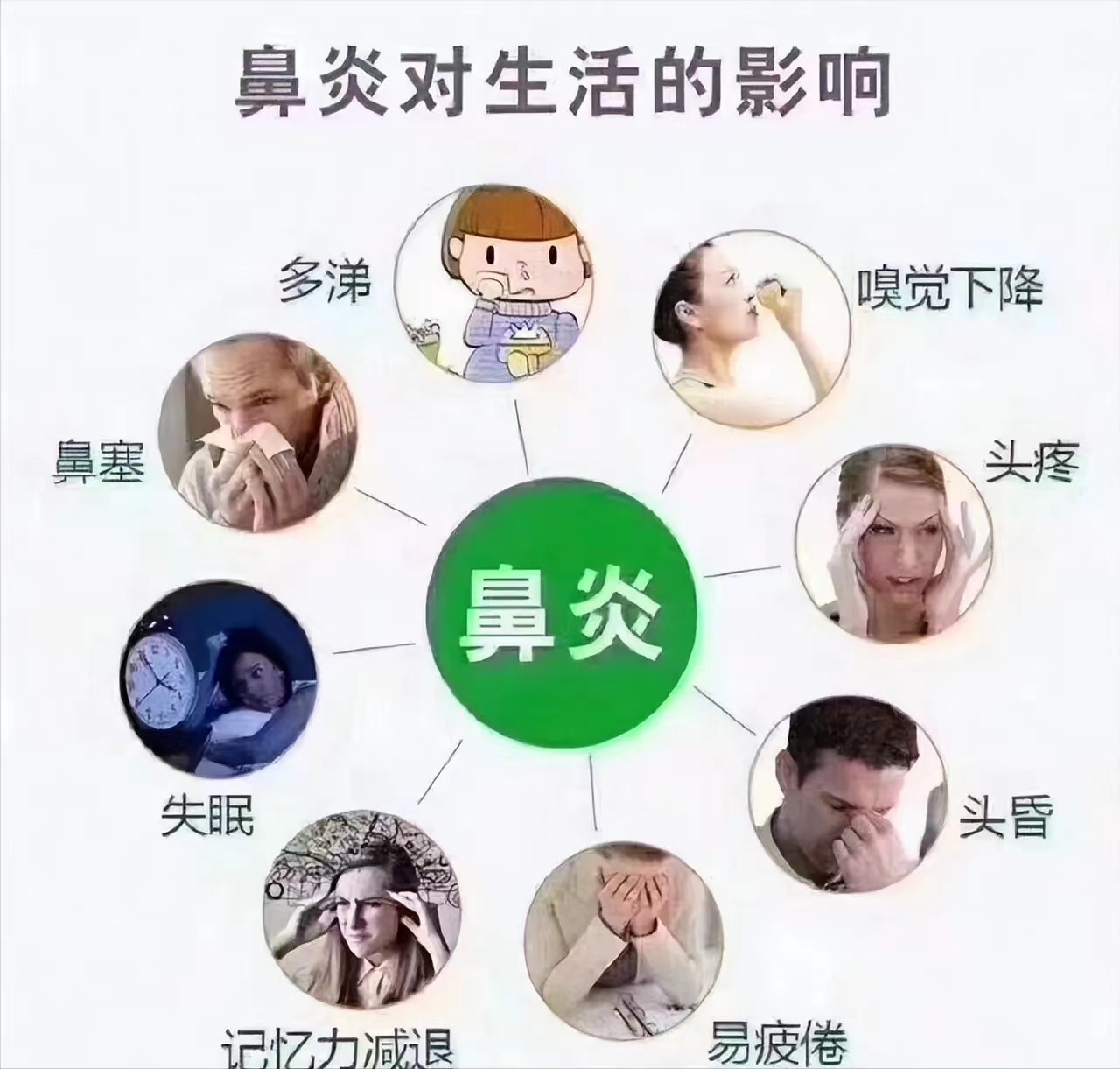 小儿鼻炎的症状有哪些