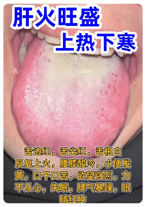 肠胃湿热的症状